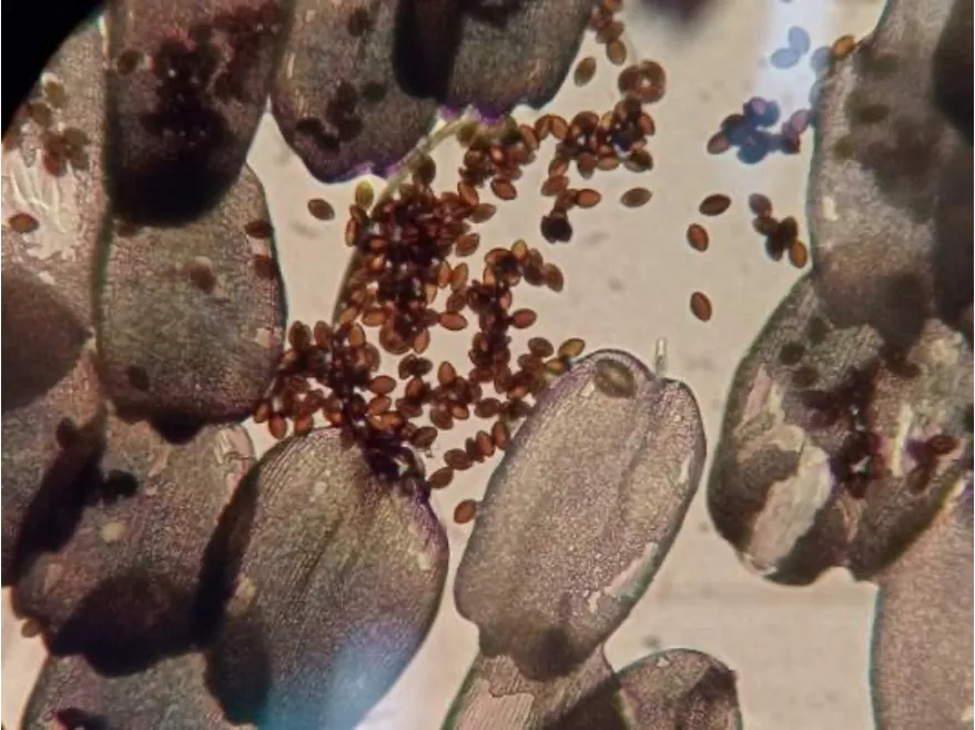 **Figura 5.** Ooquistes de OE en escamas del abdomen de una mariposa monarca. H. Ontiveros (2024).